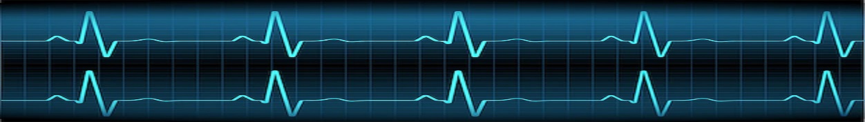 Heart rate graph